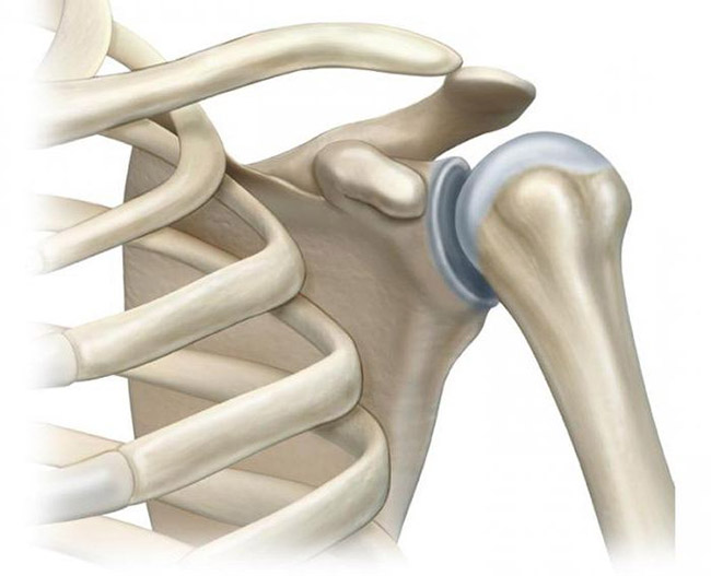 Анатомия плечевого сустава человека в норме