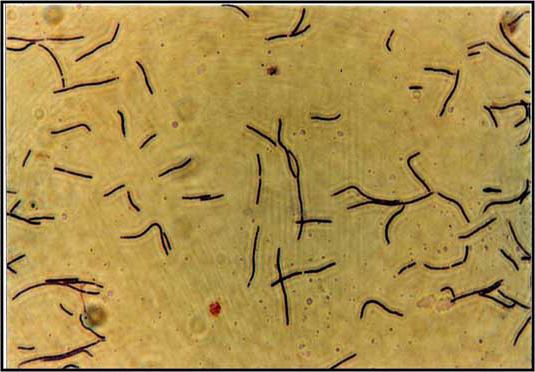 днк lactobacillus spp