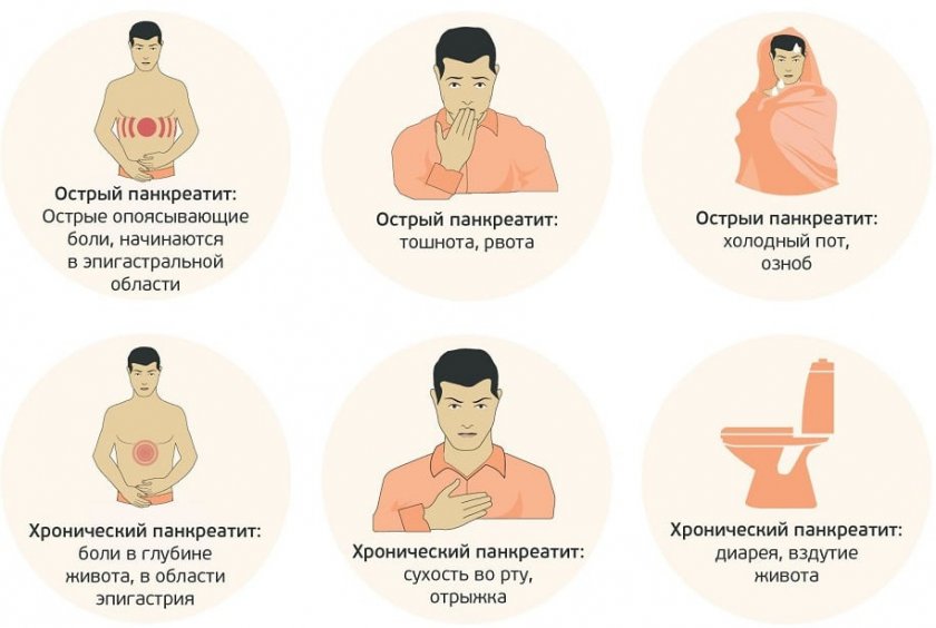 Симптомы панкреатита