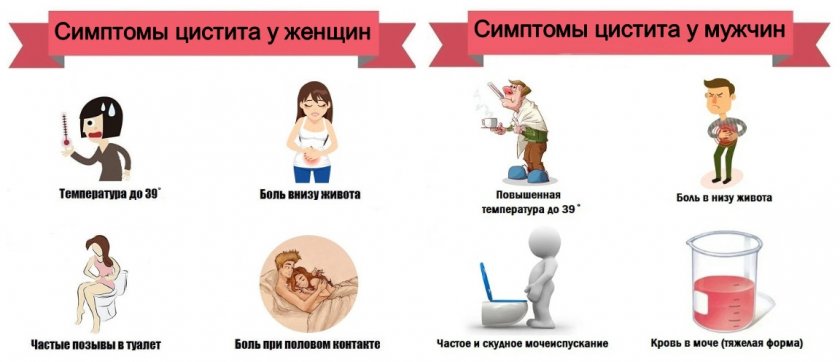 Симптоматика цистита