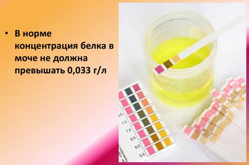 Высокие показатели белка в моче