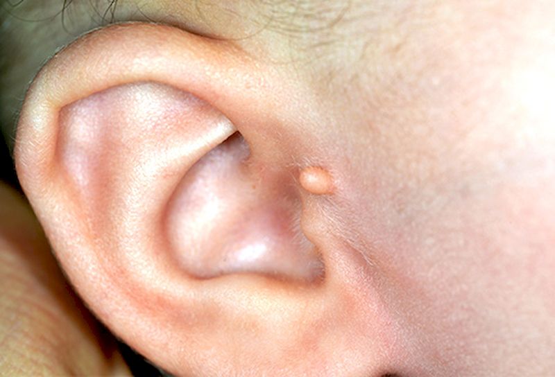 Необычная форма уха