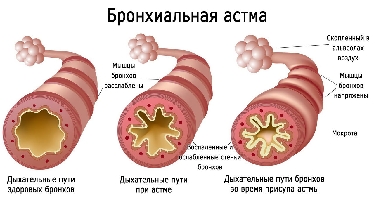 Лечебные свойства корня девясила. Рецепты, как заготовить, заваривать, принимать траву. Противопоказания