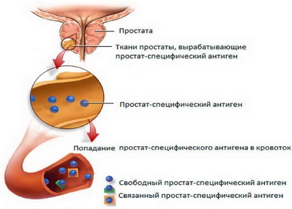Анализ ПСА. Подготовка к сдаче крови, что это такое свободный, общий, норма, таблица, цена