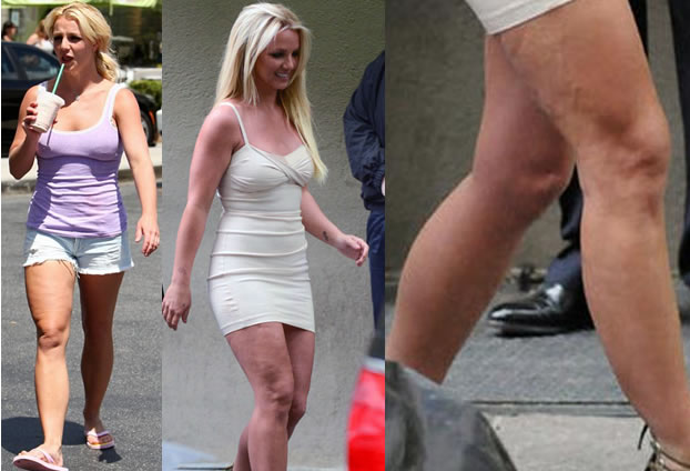 britney-spears-cellulite