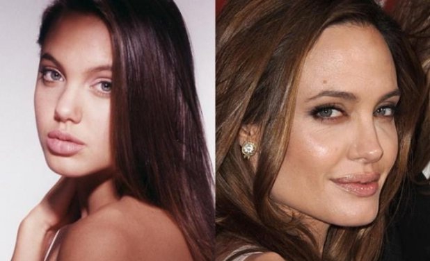 Фото Анджелины Джоли до и после пластики носа