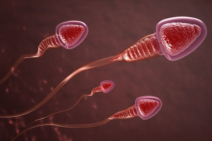 аномалии в строении сперматозоидов