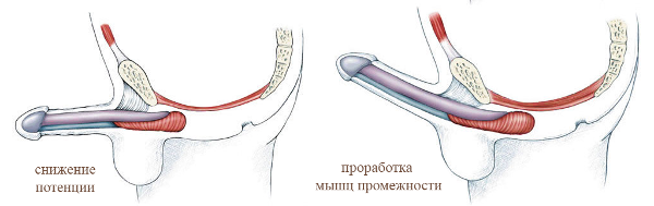 Проработка интимных мышц положительно сказывается на эректильной способности мужчины