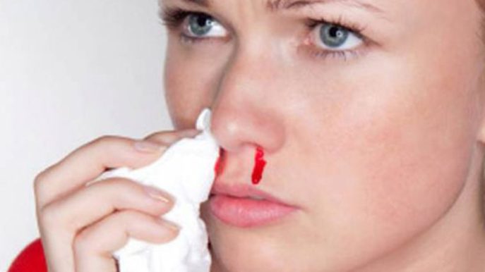 Методы остановки носового кровотечения в домашних условиях
