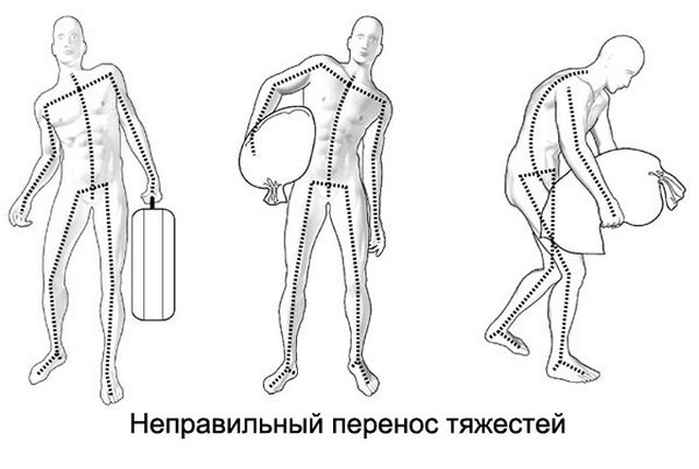 Советуем запомнить: так переносить тяжести ни в коем случае нельзя!