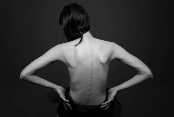 Если мышцы спины не тренированные, то высок риск развития заболеваний позвоночника