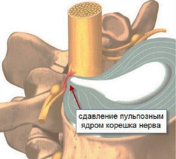 Боли в сердце