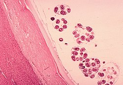 Echinococcus granulosus scolex.jpg
