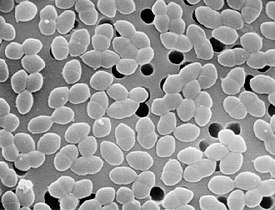 Entercoccus sp2 lores.jpg