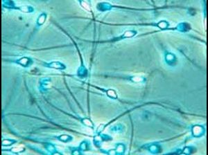 Сперматозоиды в норме и в патологии