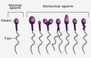 Норма в спермограмме