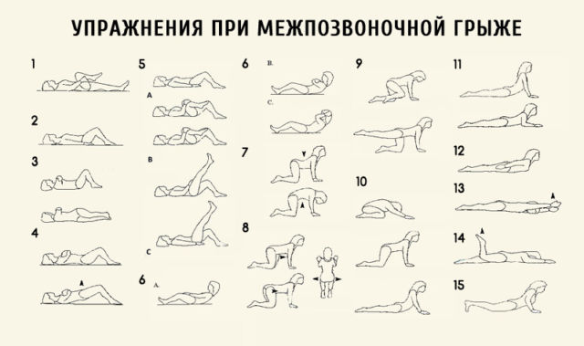 Лечебный комплекс упражнений при грыже поясничного отдела позвоночника