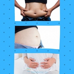 5 типов живота, не связанных с лишним жиром, и как от них избавиться