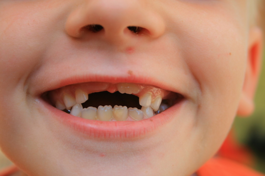До скольки лет растут зубы у детей