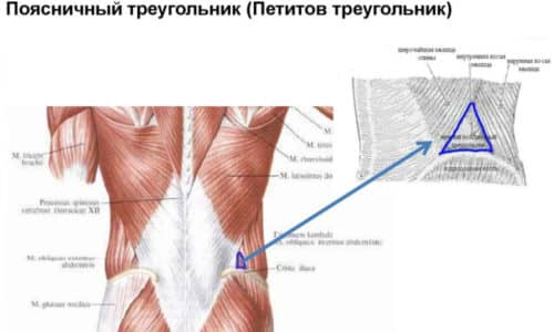 Поясничный треугольник ограничивается сзади широчайшей мышцей спины, спереди - косой наружной мышцей живота, снизу - гребнем подвздошной кости