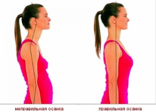 Как выровнять спину от сутулости. Лечение 04
