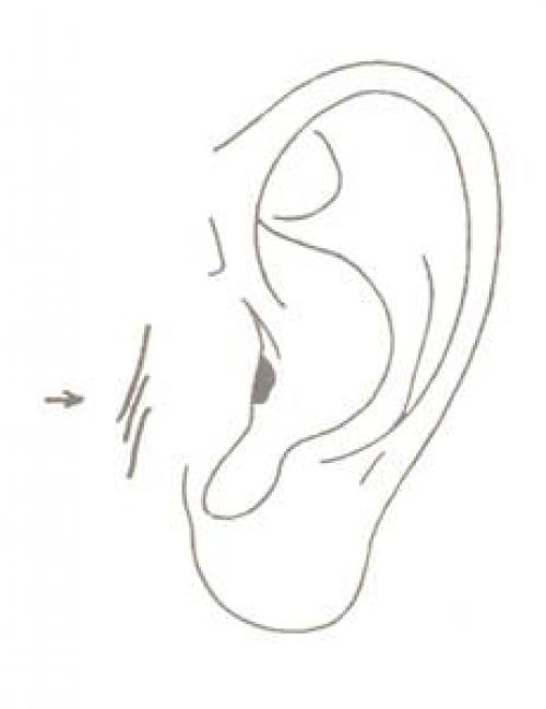 Болезни по ушам. Как определить болезни по ушам человека?
