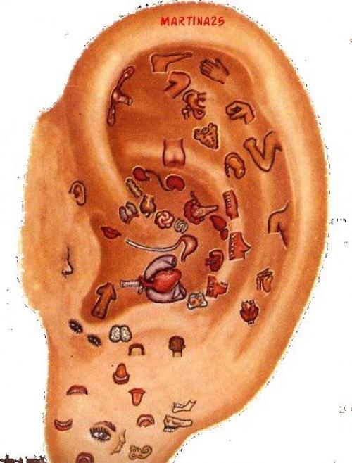 Болезни по ушам. Диагностика болезней по ушам.